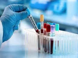 Blood Tests & Lab Work